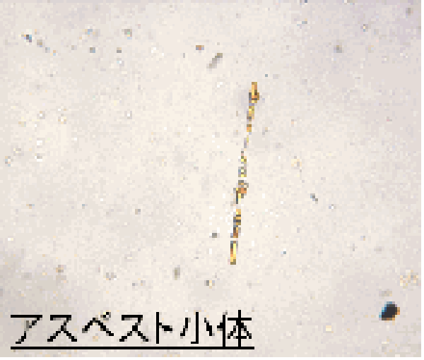 アスベスト小体
