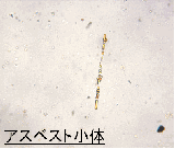 確認されたアスベスト小体